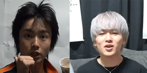 ウマヅラの整形疑惑を解明！