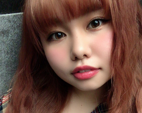 整形疑惑はある？